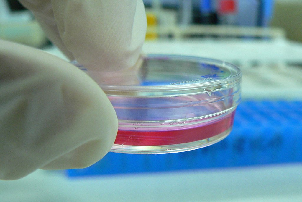 Cell culture dishes in a laboratory