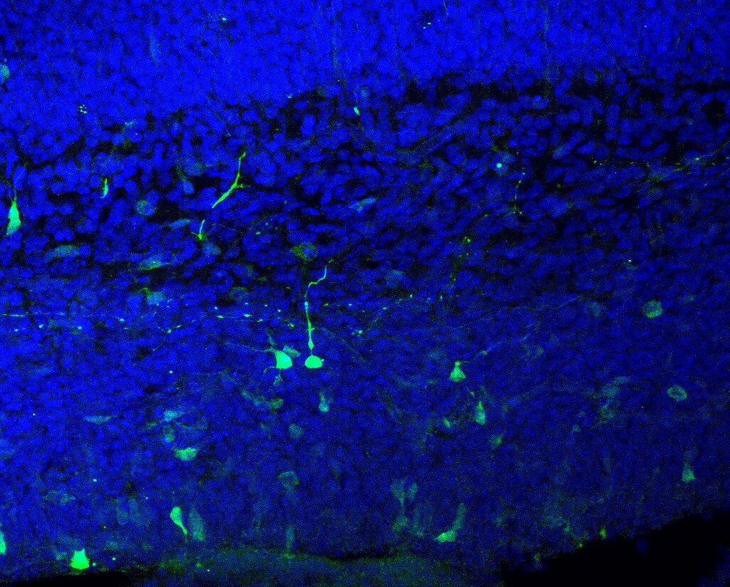 Fluorescence microscopy of an embryonic mouse brain